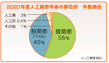 人工関節の部位別手術割合