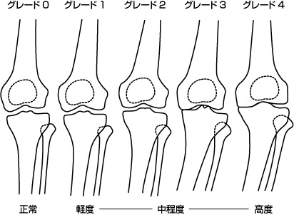 K-L分類