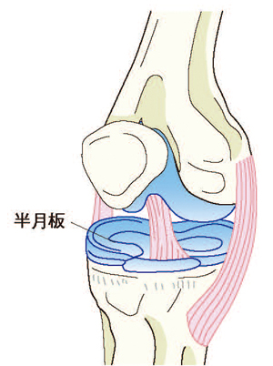 半月板