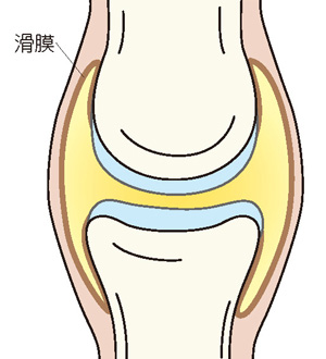 滑膜