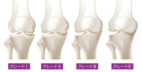 KL分類